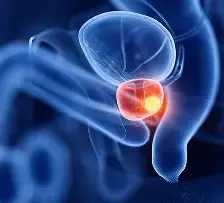 Prosta2Power result no.1